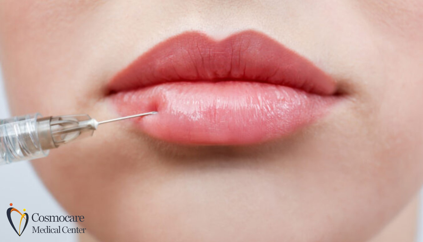 Mesotherapy in Dubai by Cosmocare Medical Center